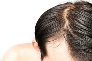 ساختار مو و انواع جنس مو